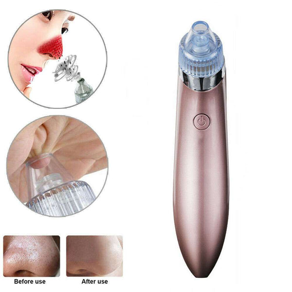 Electric Blackhead Vacuum Pore Cleaner - Strong Suction Tool