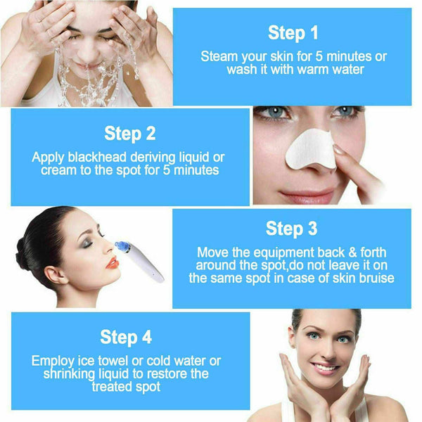 Electric Blackhead Vacuum Pore Cleaner - Strong Suction Tool