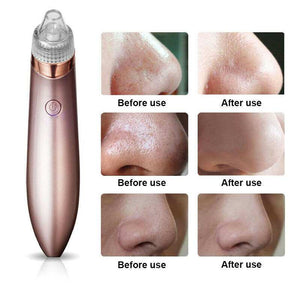 Electric Blackhead Vacuum Pore Cleaner - Strong Suction Tool
