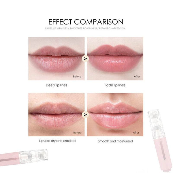 3 In 1 Lip Care Roller 