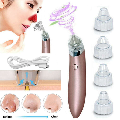 Electric Blackhead Vacuum Pore Cleaner - Strong Suction Tool