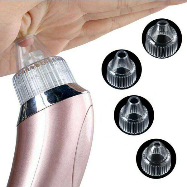 Electric Blackhead Vacuum Pore Cleaner - Strong Suction Tool